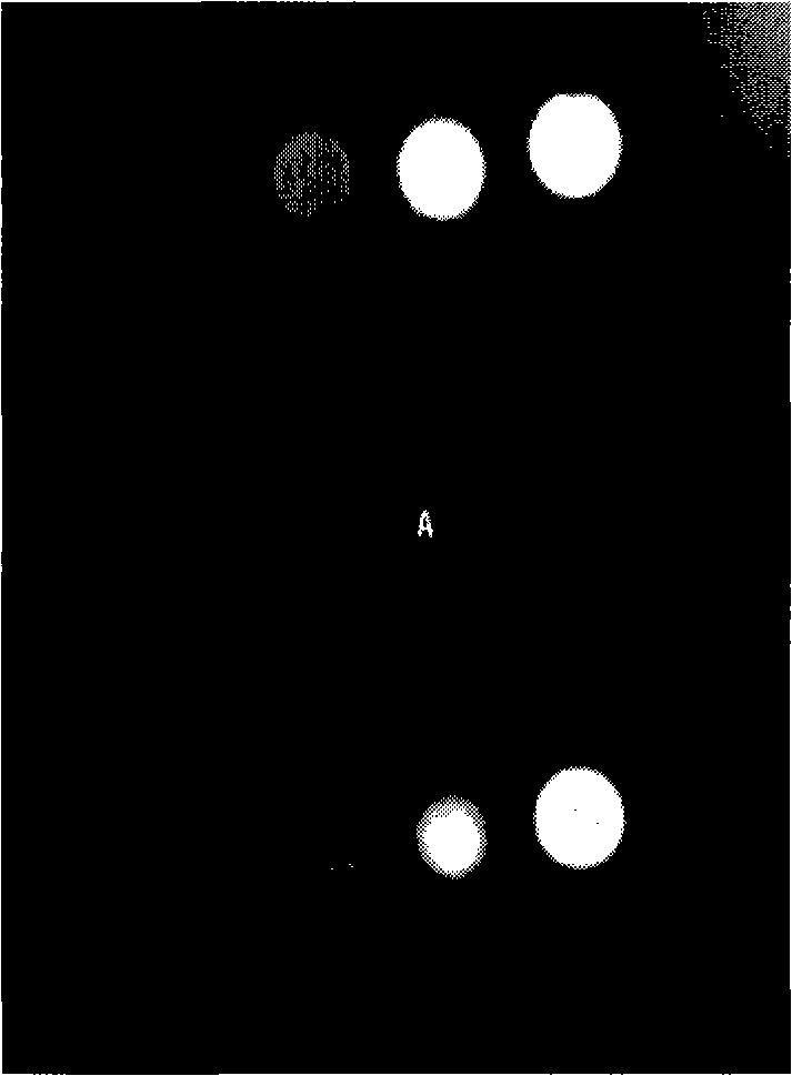 Contrast agent for MR cholangiopancreatography