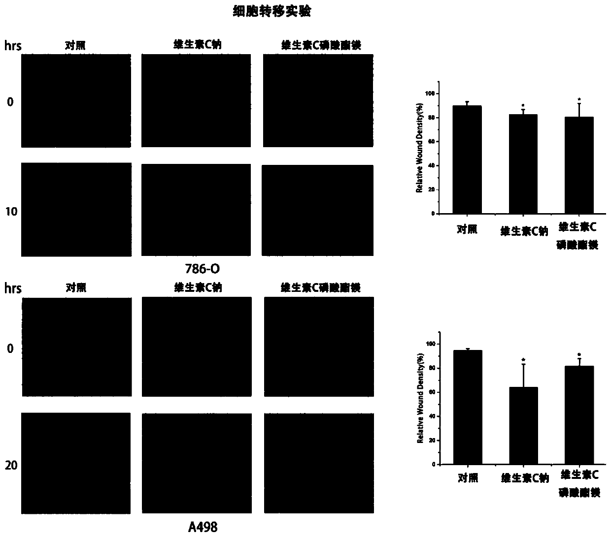 Application of Vitamin C Derivatives in Preparation of Antitumor Products