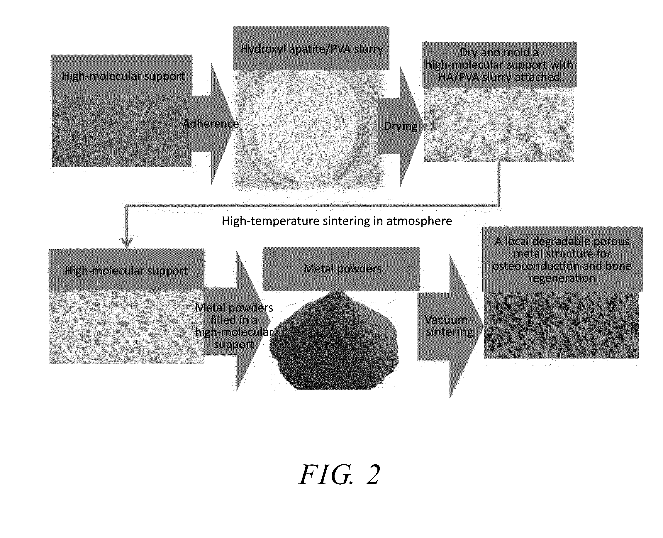 Intervertebral Implant