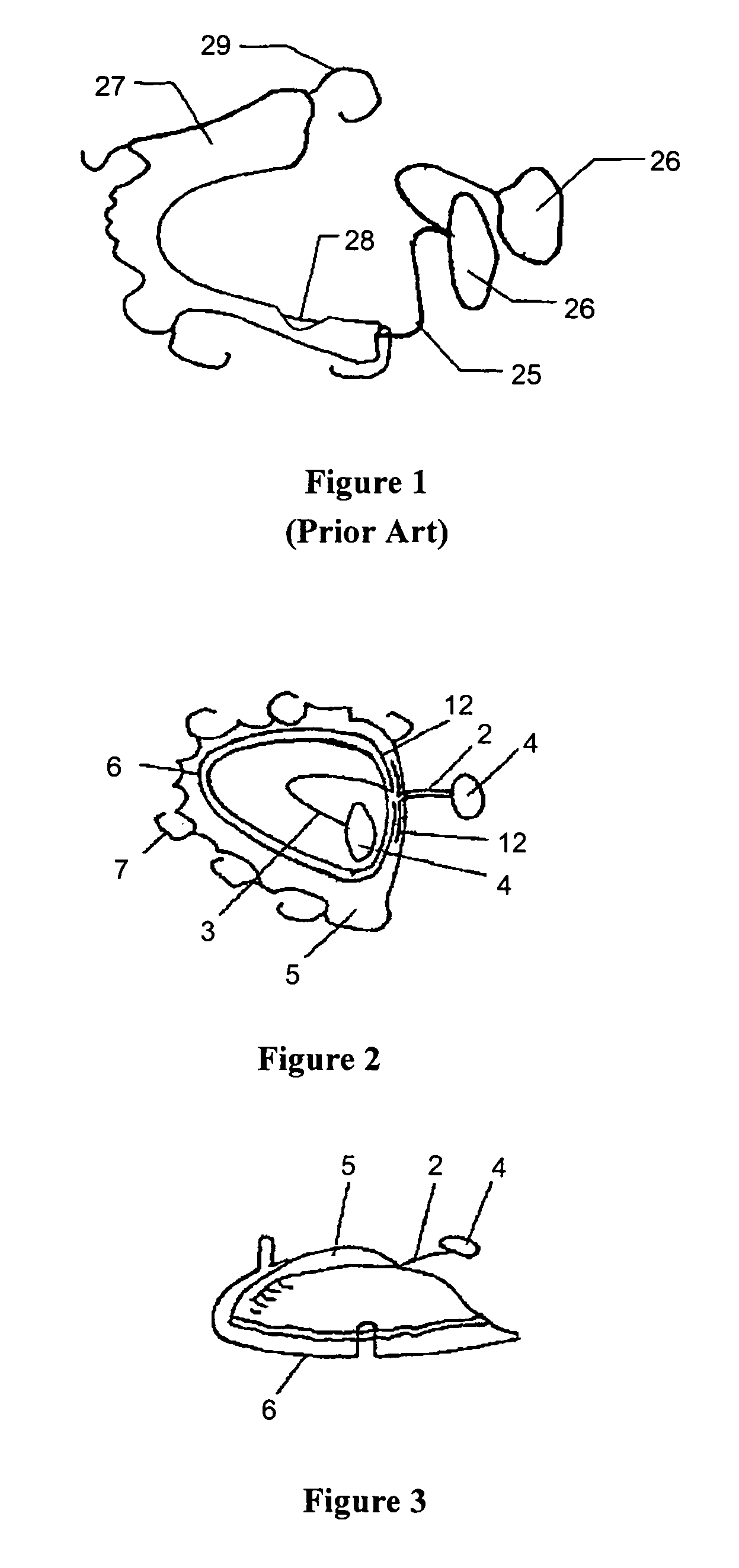 Removable tongue position corrective anti-snoring and anti-suffocating device