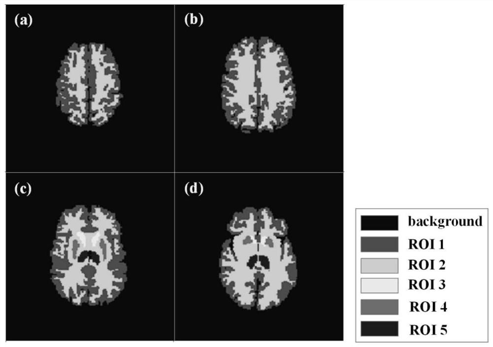 A low-dose dual-tracer PET reconstruction method based on attention mechanism