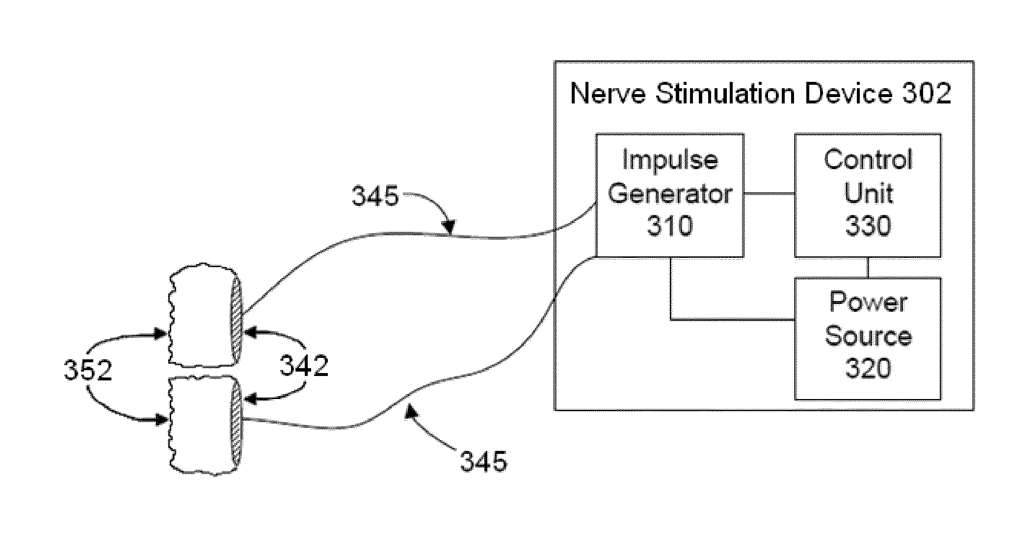 Electrical and magnetic stimulators used to treat migraine/sinus headache, rhinitis, sinusitis, rhinosinusitis, and comorbid disorders