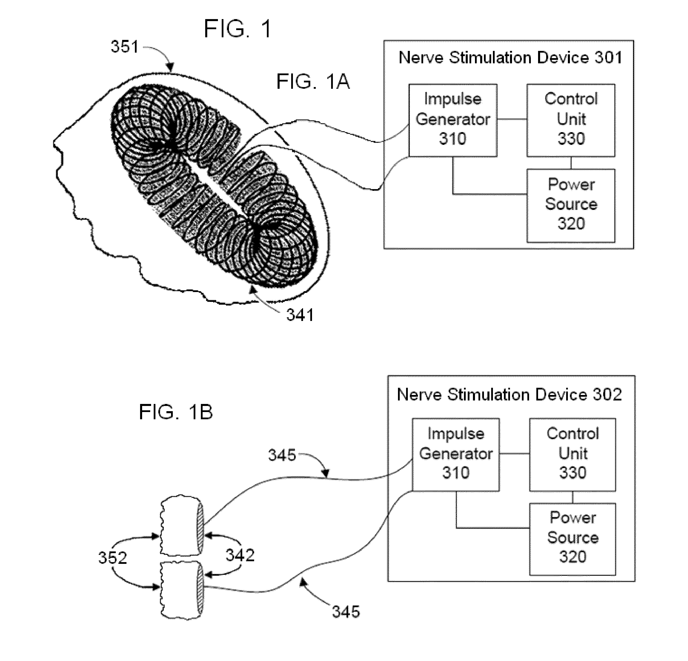 Electrical and magnetic stimulators used to treat migraine/sinus headache, rhinitis, sinusitis, rhinosinusitis, and comorbid disorders