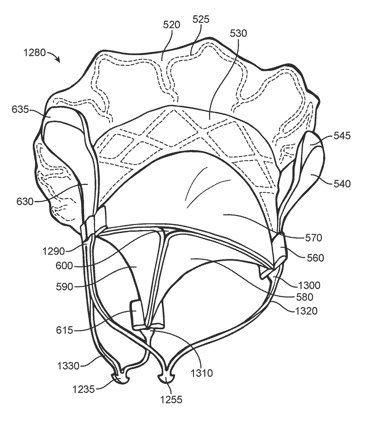 Prosthetic valve for avoiding obstruction of outflow