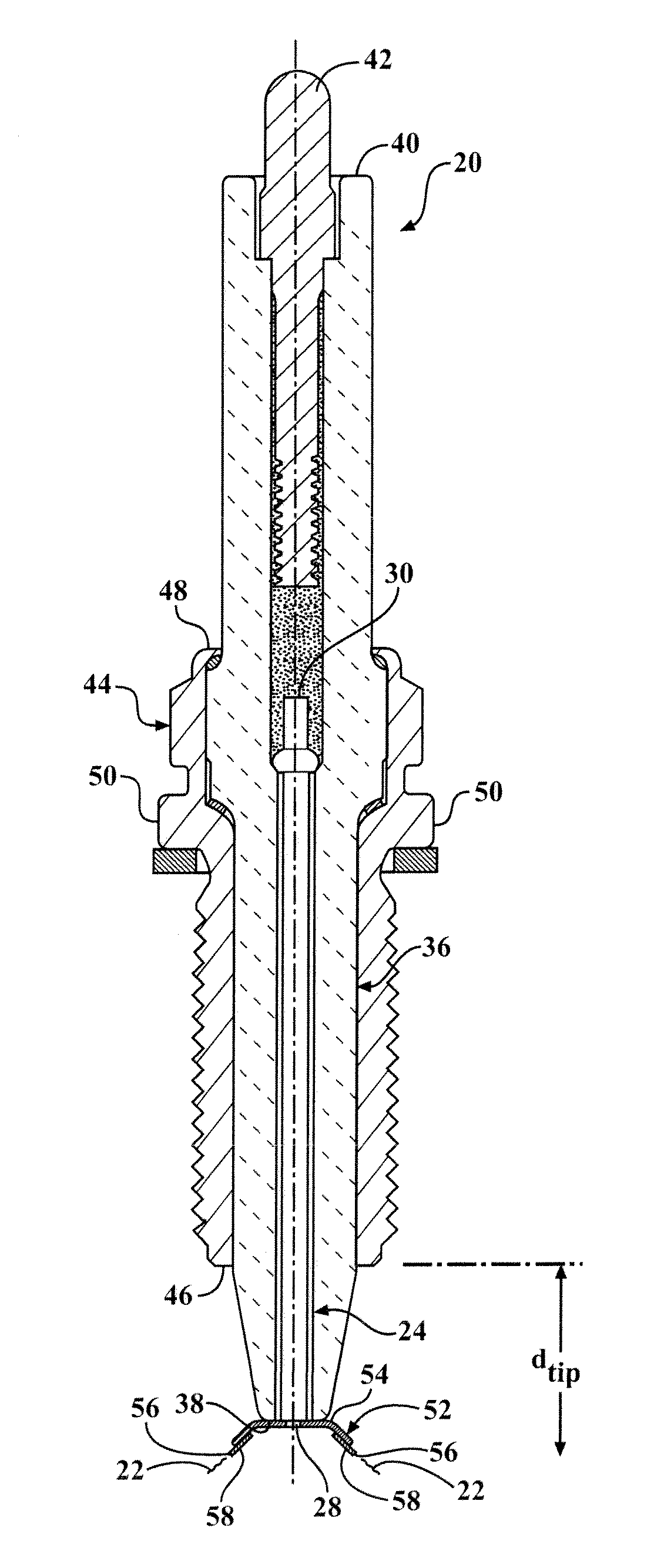 Igniter including a corona enhancing electrode tip