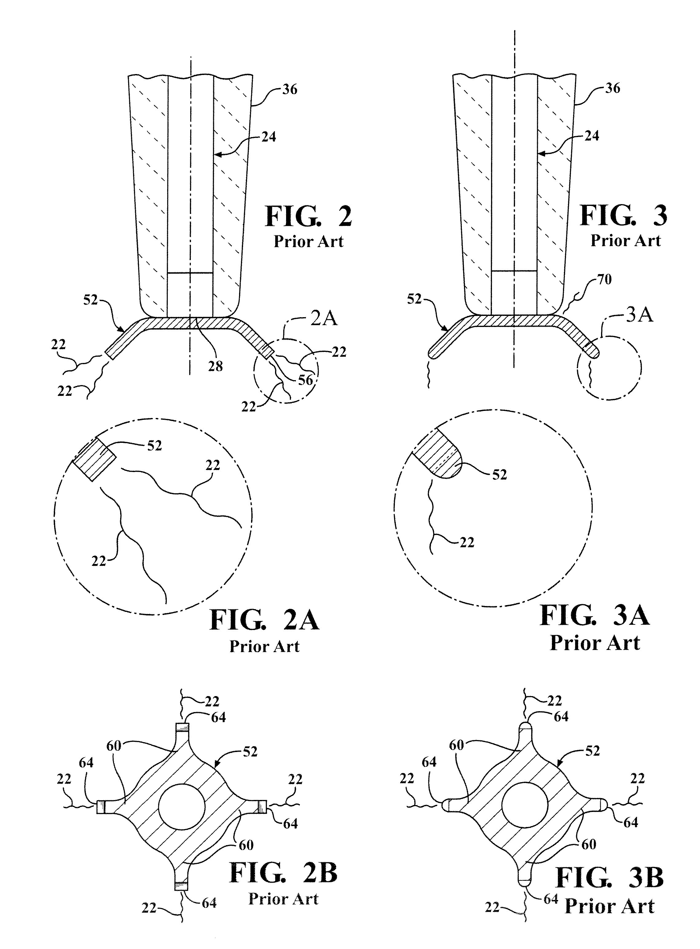 Igniter including a corona enhancing electrode tip