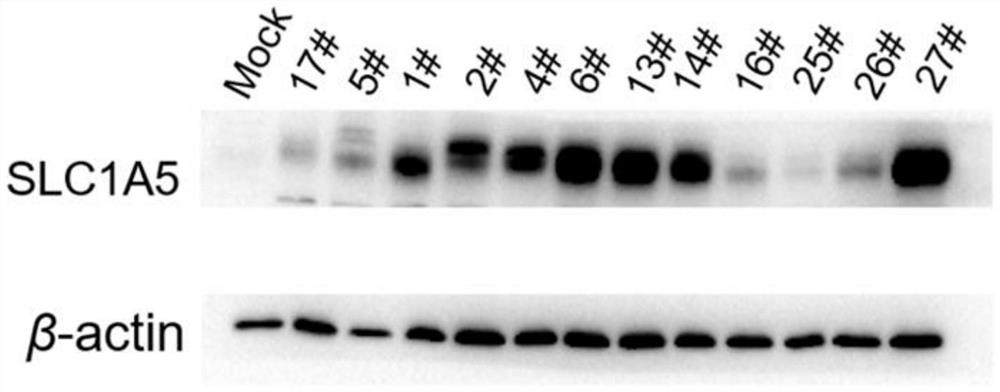 Method for screening glutamine transporter inhibitor, inhibitor screened by adopting method and application of inhibitor