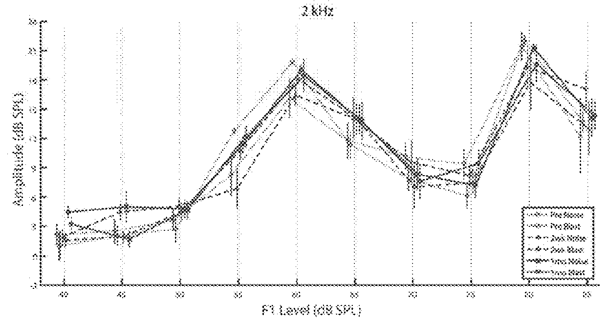 Changes in auditory evoked responses as simple, rapid biomarkers for blast injury and other traumatic brain injuries