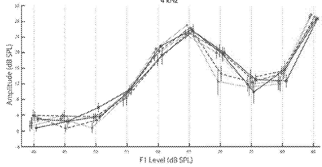 Changes in auditory evoked responses as simple, rapid biomarkers for blast injury and other traumatic brain injuries