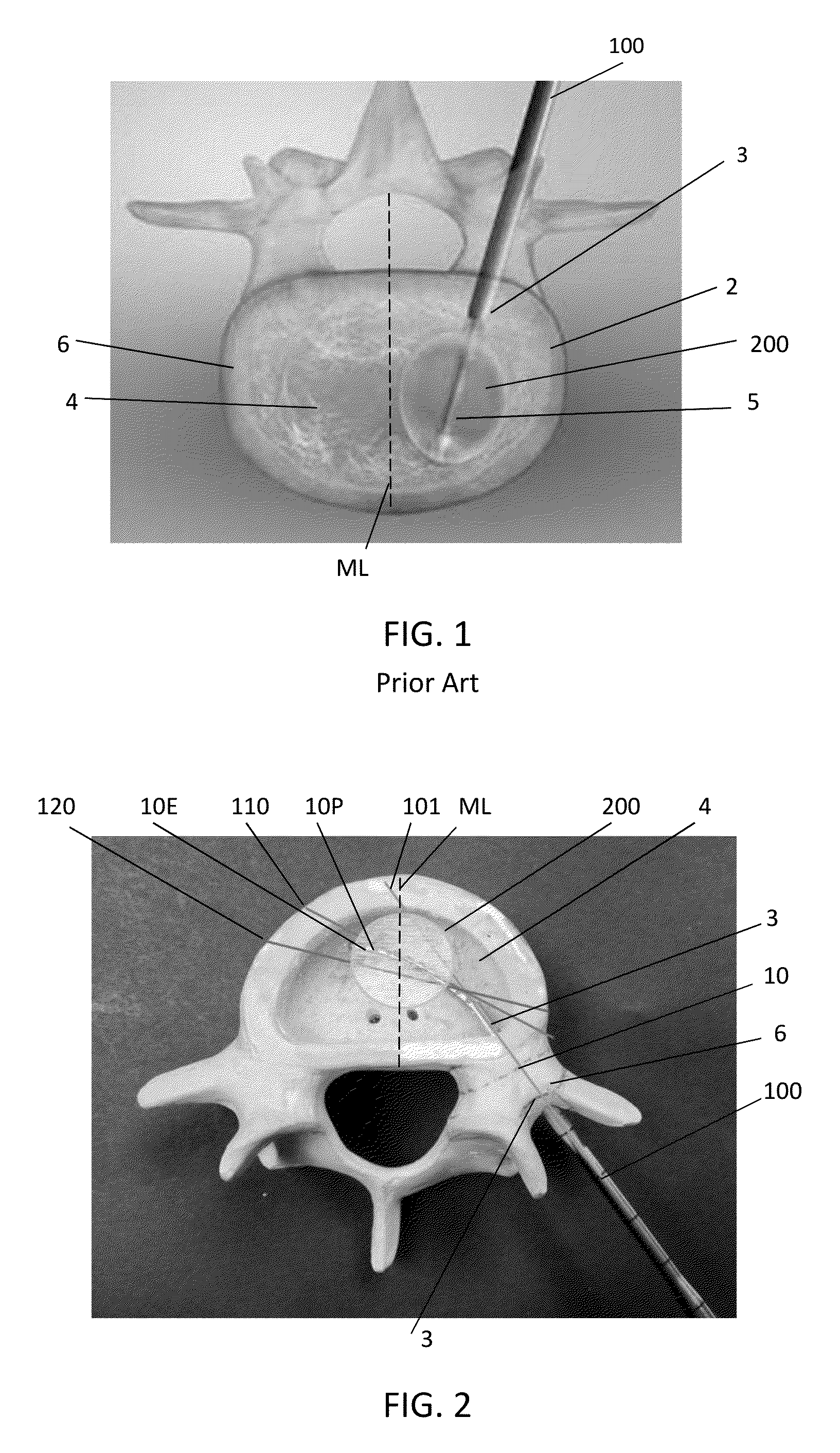 Tunneling device