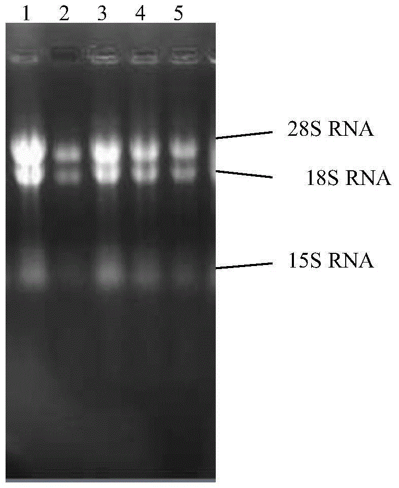 Arginase from Cordyceps sinensis, its coding gene and its application