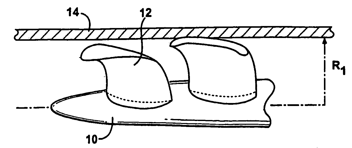 Expandable impeller pump