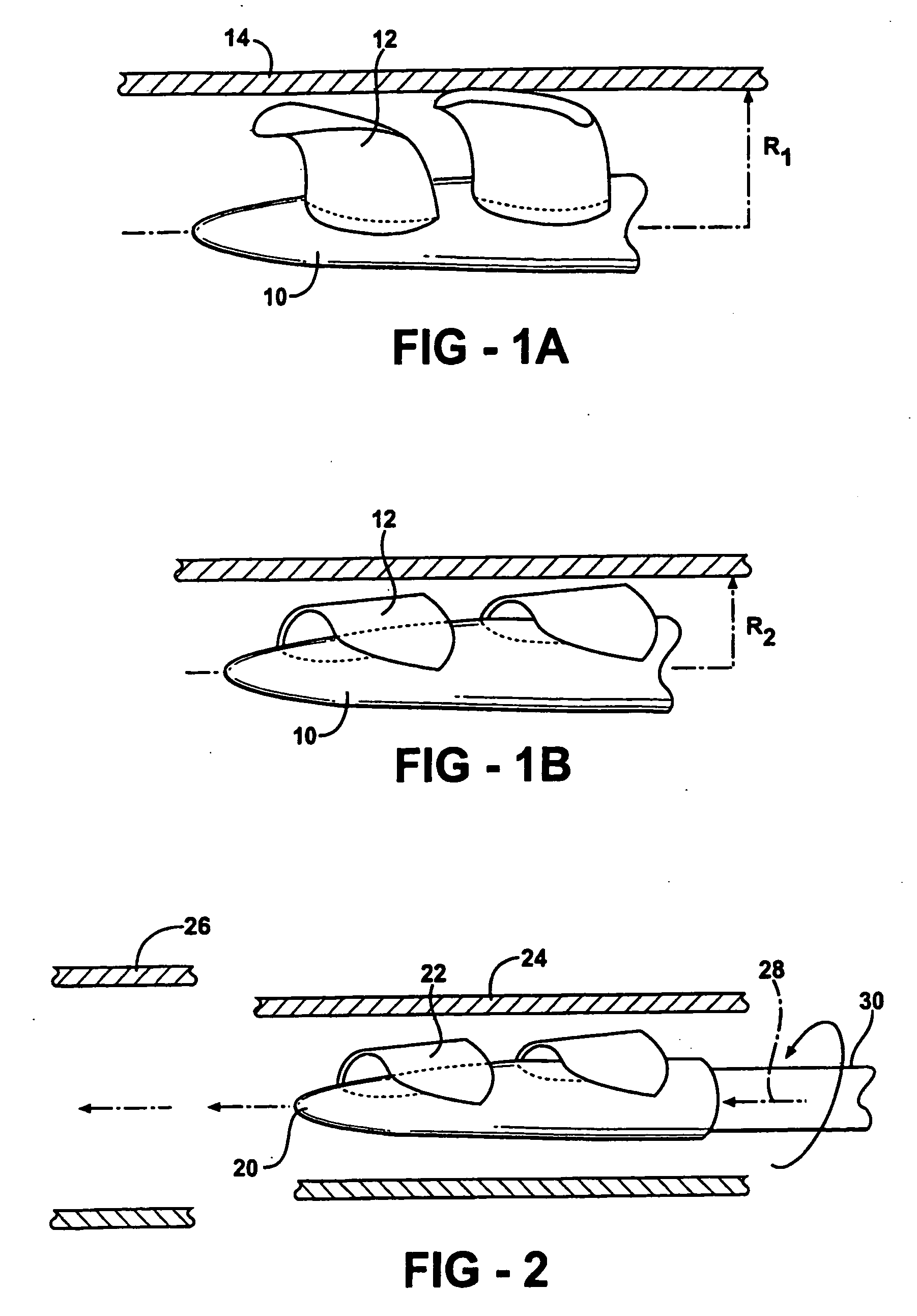 Expandable impeller pump