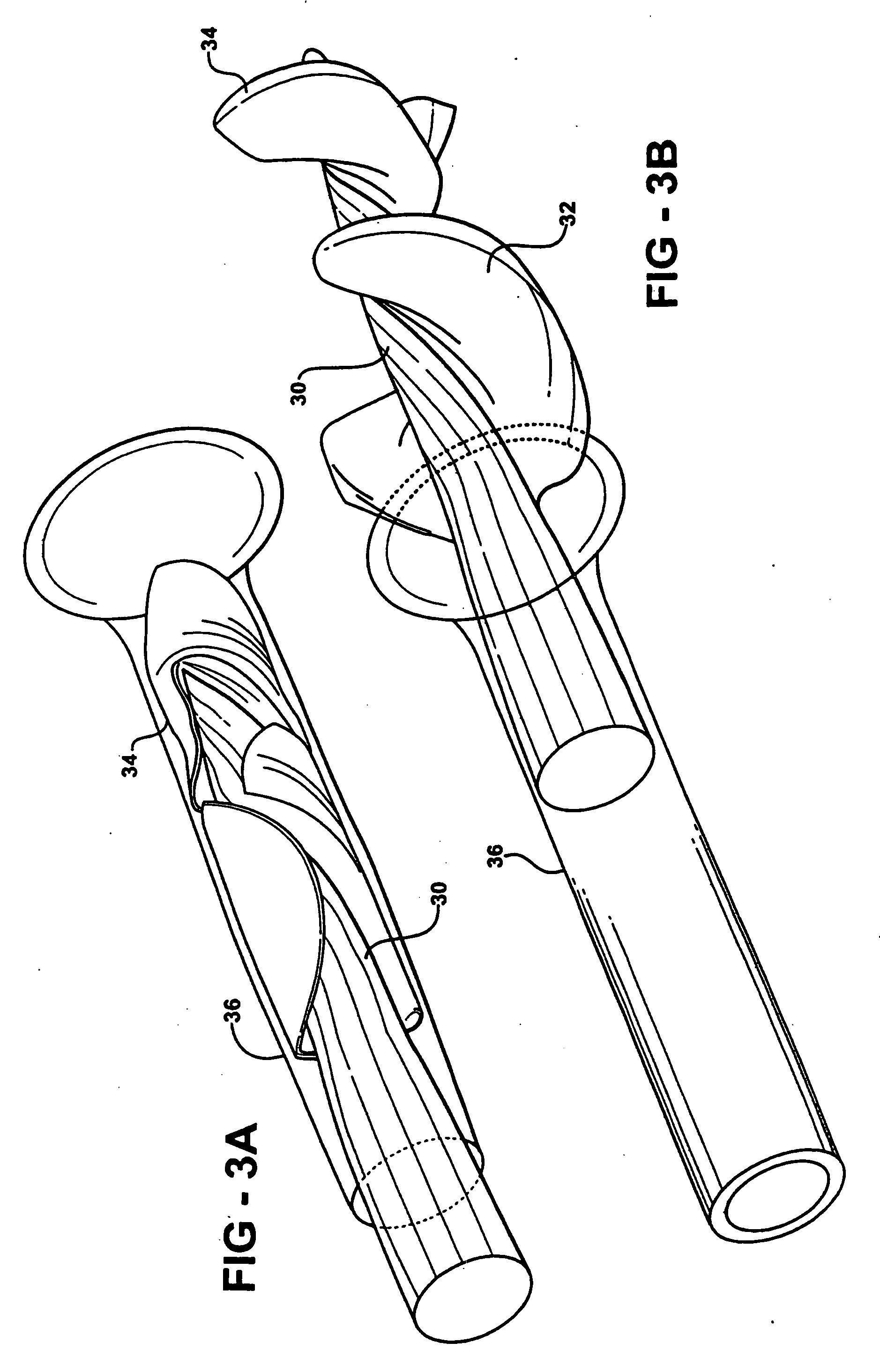 Expandable impeller pump