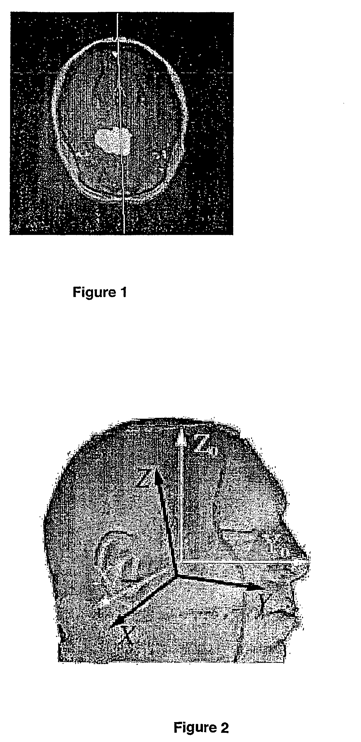 Method and apparatus for determining symmetry in 2d and 3d images