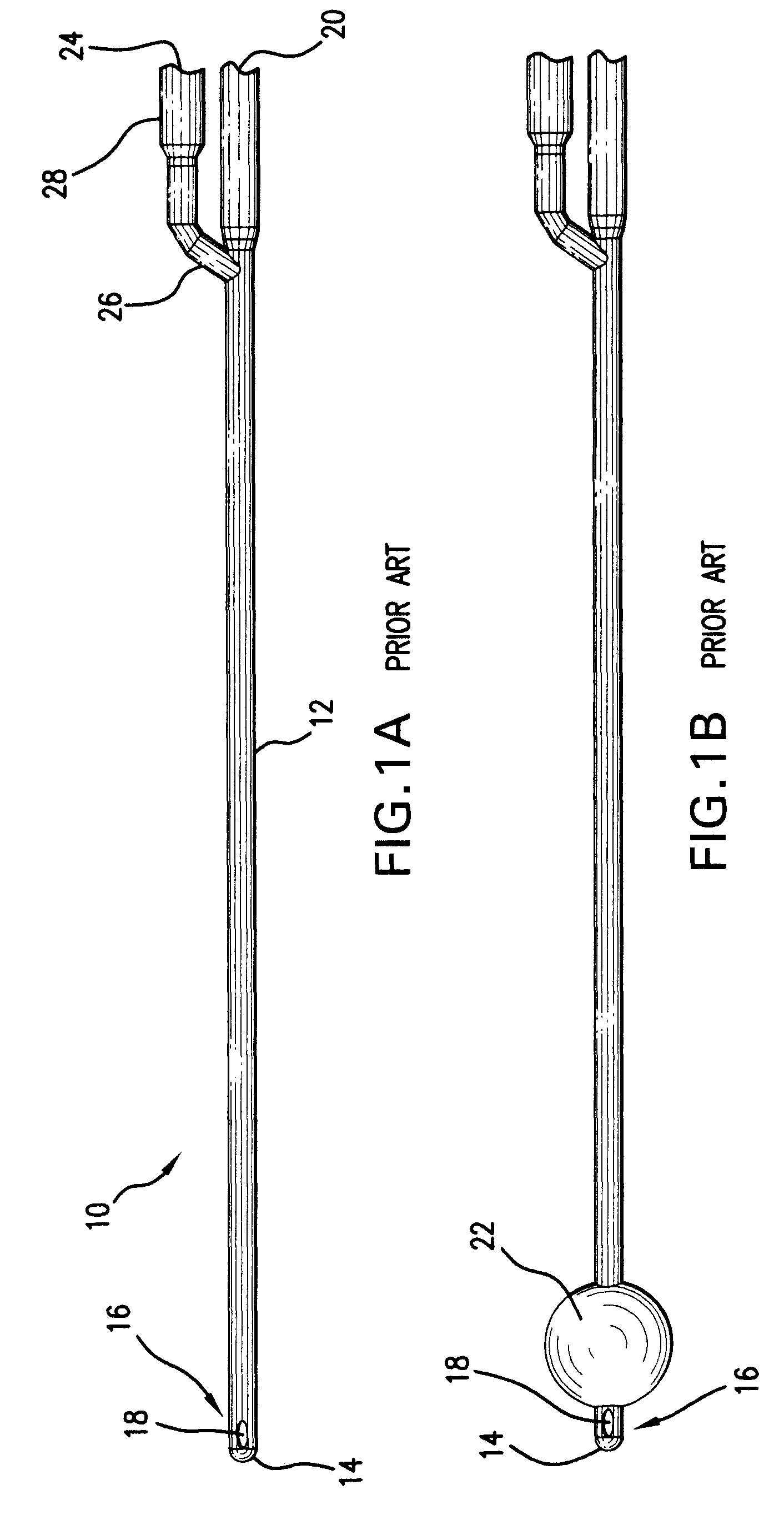 Indwelling urinary catheter with self-retaining mechanism