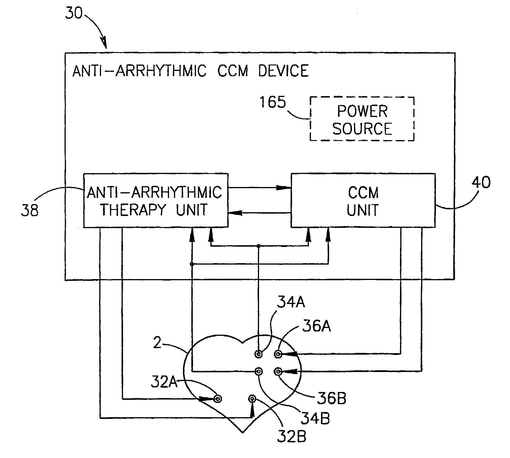 Cardiac contractility modulation device having anti-arrhythmic capabilities and a method of operating thereof