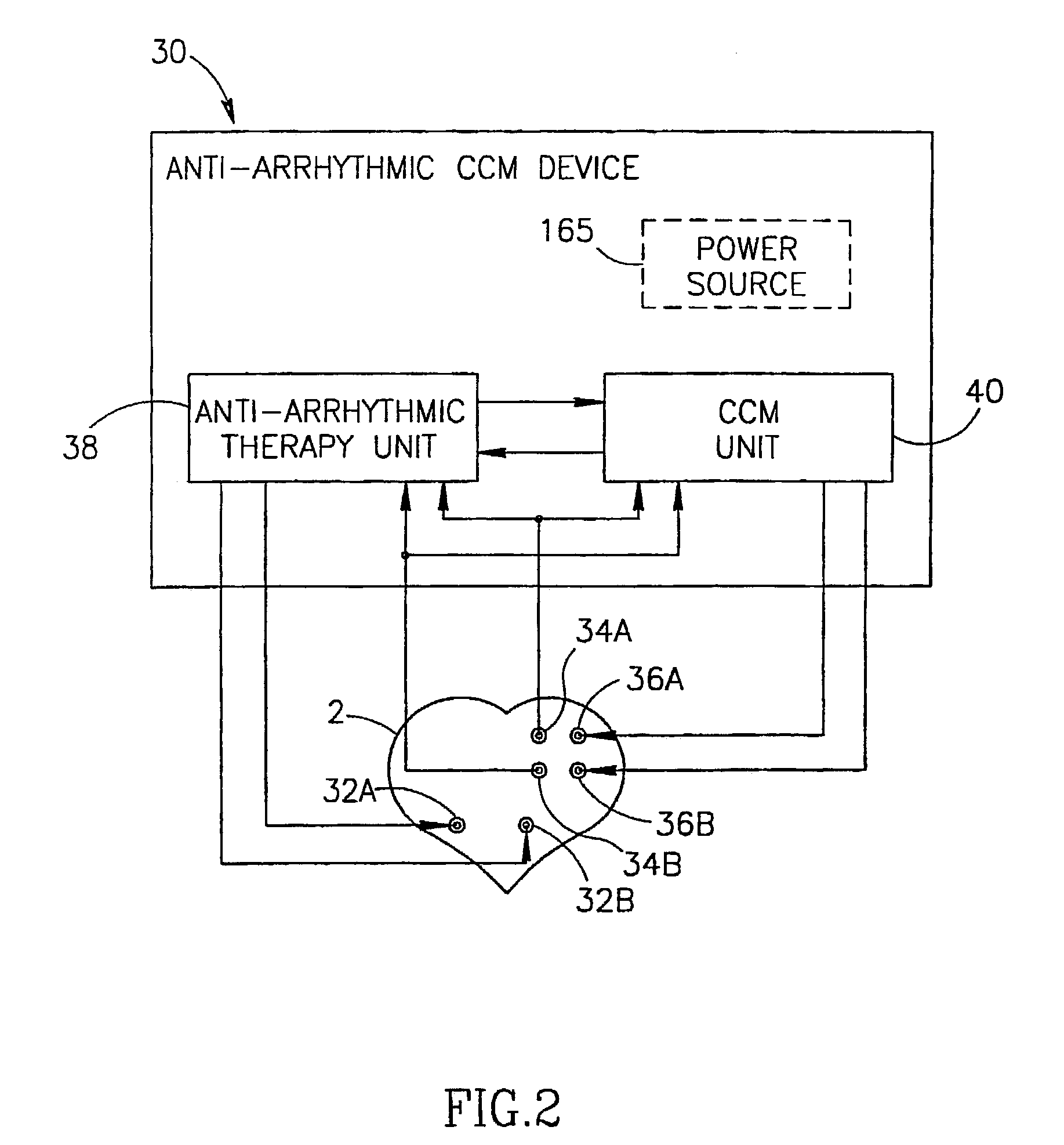 Cardiac contractility modulation device having anti-arrhythmic capabilities and a method of operating thereof