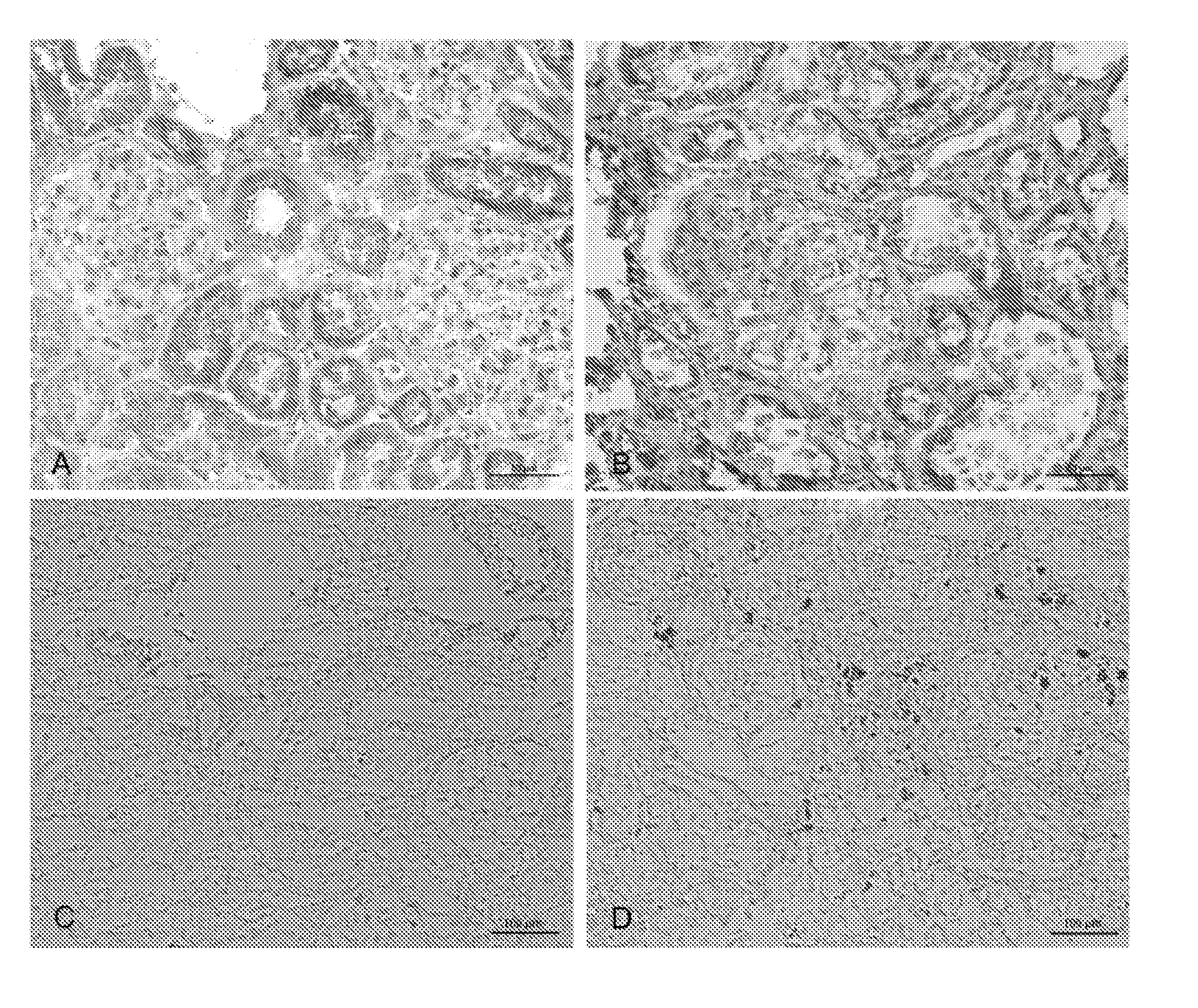 Methods and Compositions for the Treatment of Chronic Renal Hypertension