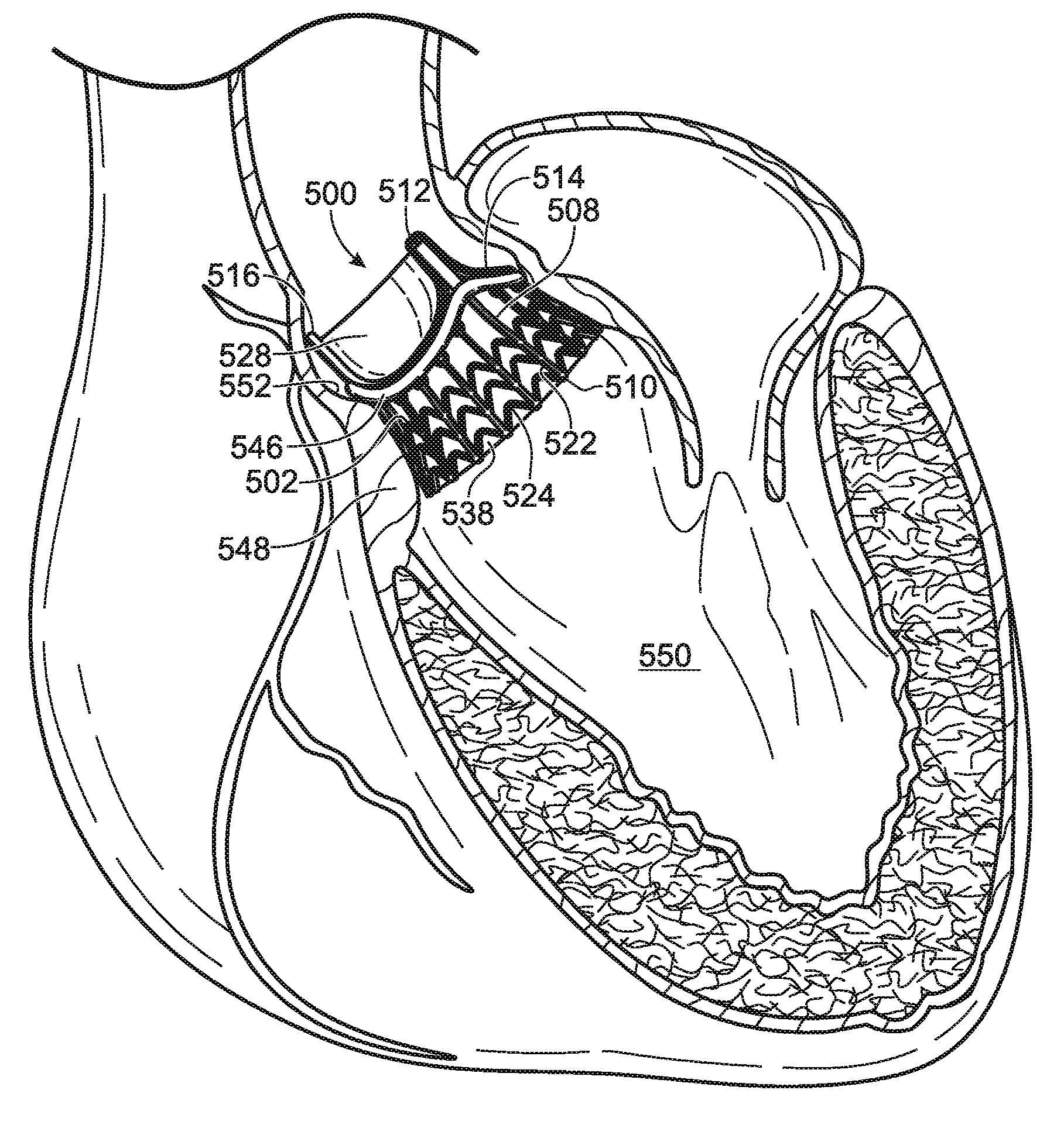 Methods of delivery of flexible heart valves