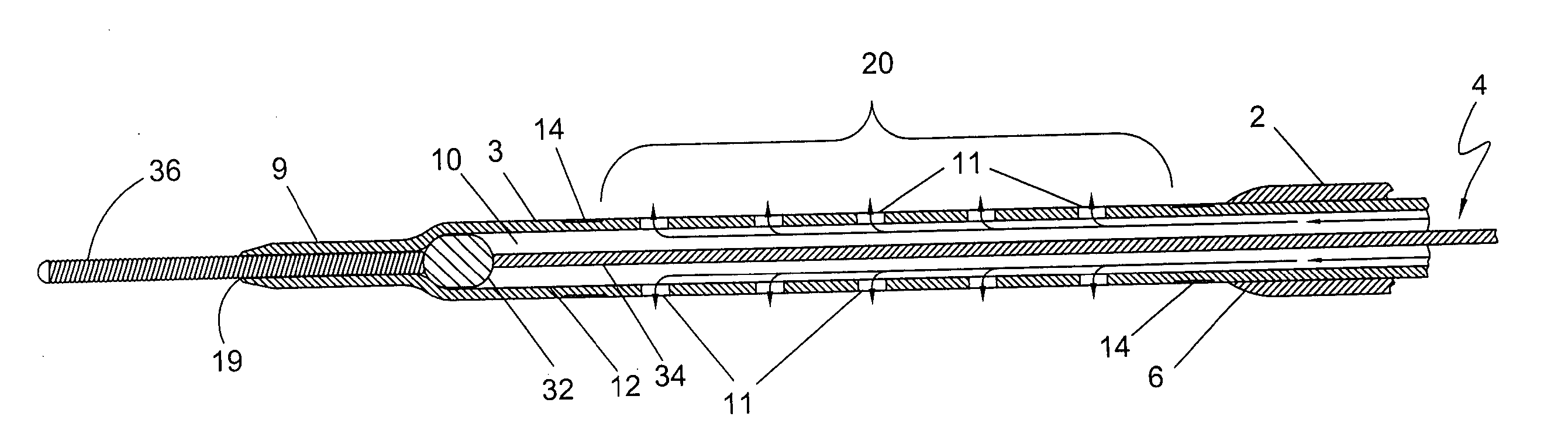 Venous insufficiency treatment method