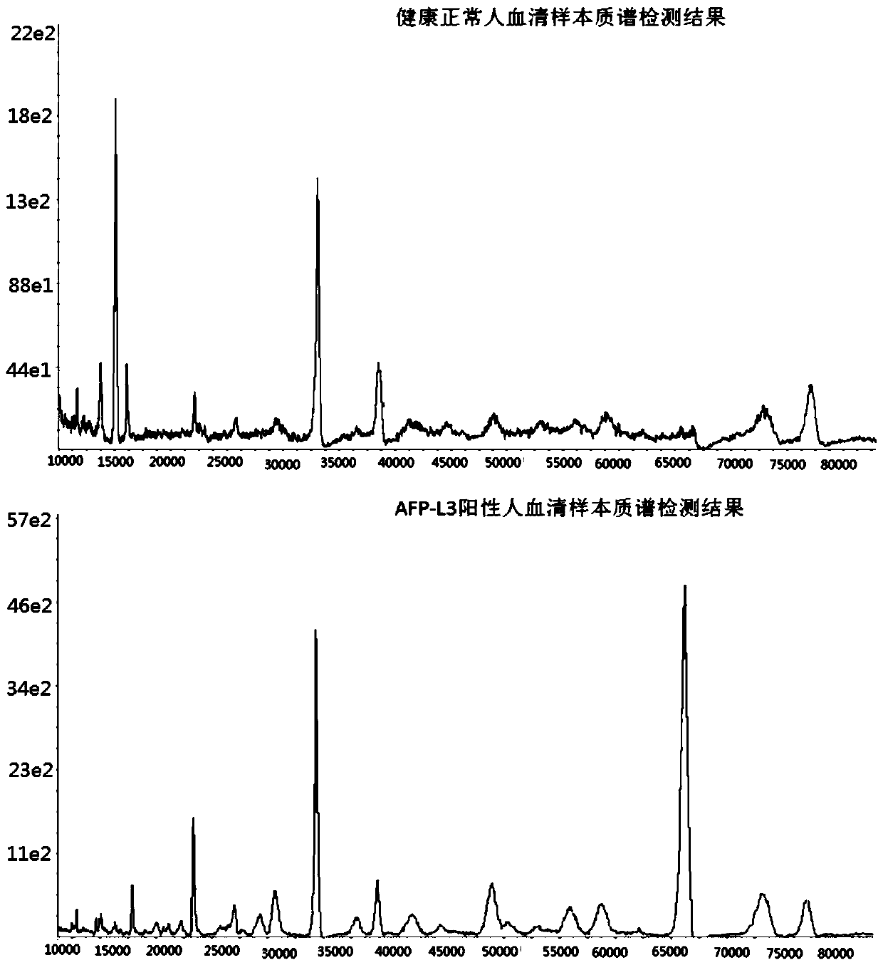 Pretreatment composition, pretreatment method and application of abnormal protein of sugar chain structure suitable for mass spectrometric detection