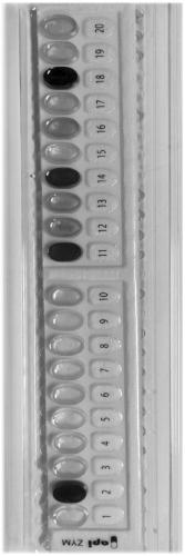 Bacteroides vulgaris strain and application thereof in preparation of medicines for treating inflammatory bowel diseases