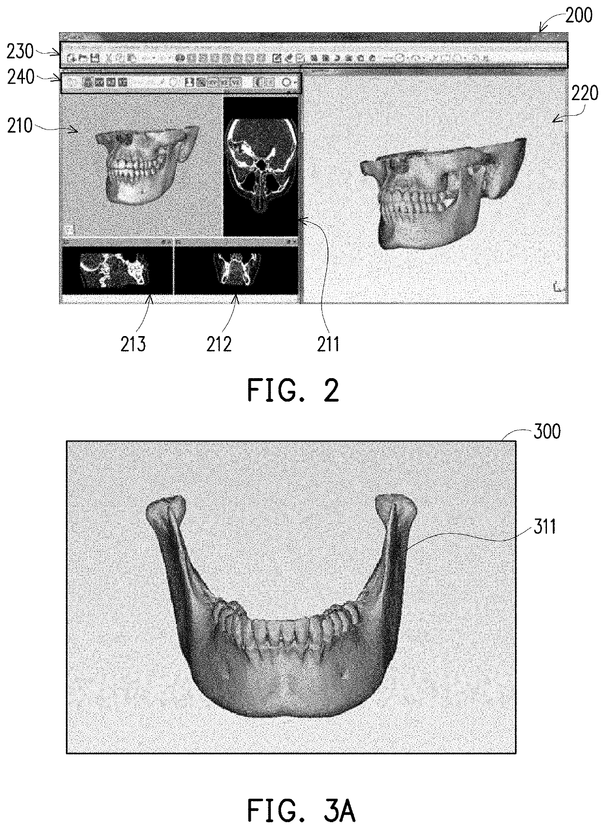 Medical image modeling system and medical image modeling method