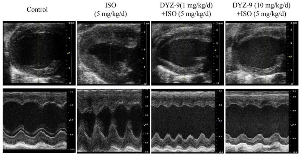 Application of dyz-9 in the preparation of anti-cardiac hypertrophy products