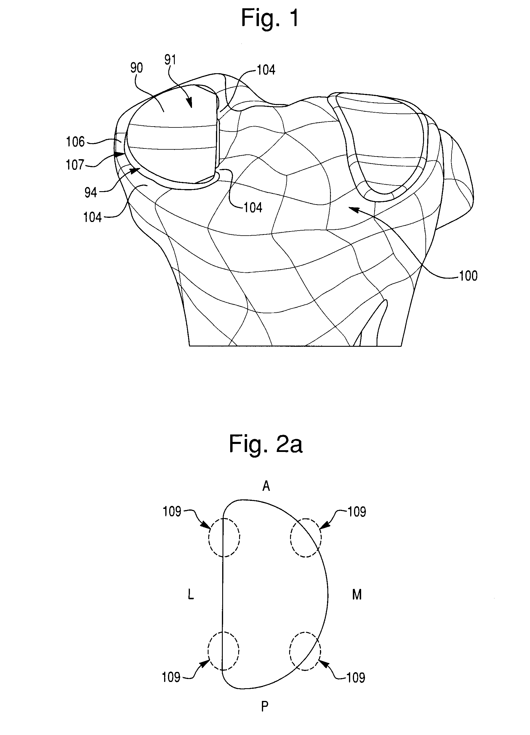 Prosthetic device, method of planning bone removal for implantation of prosthetic device, and robotic system