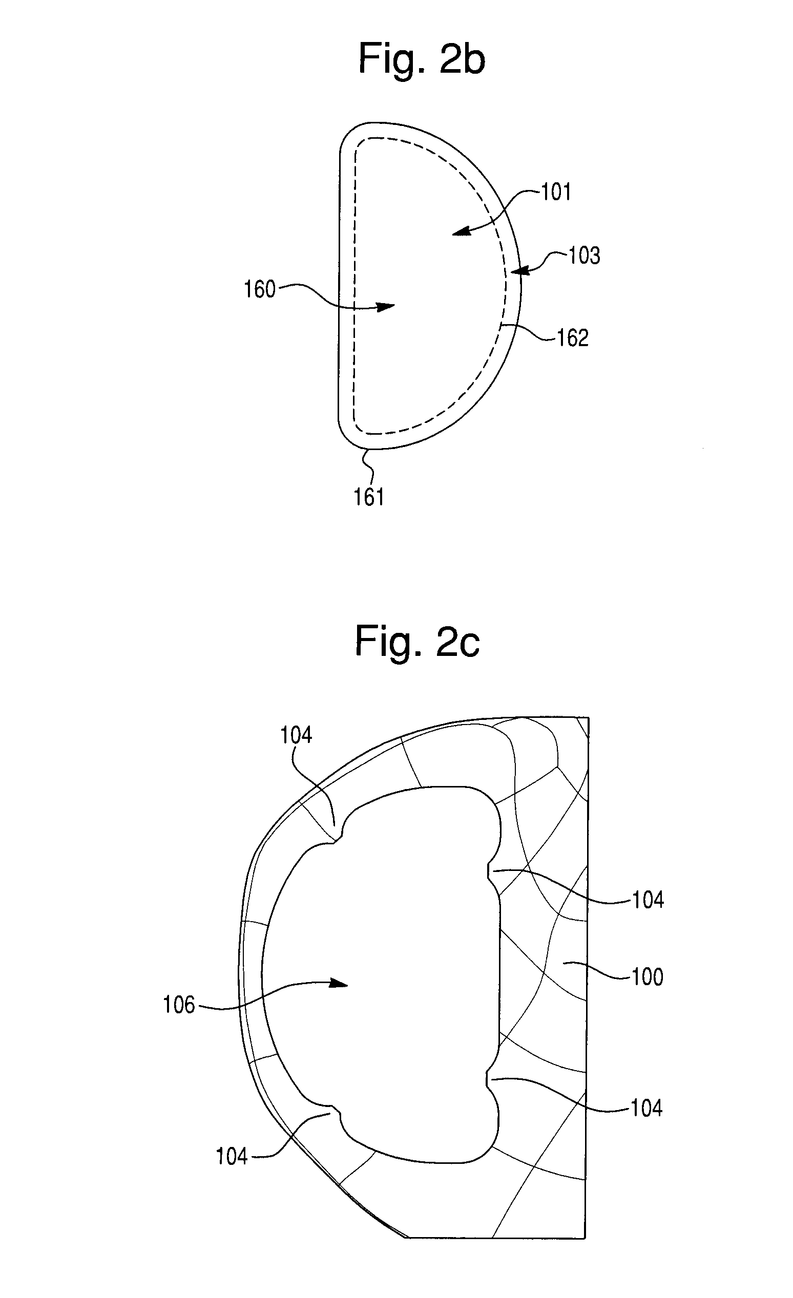 Prosthetic device, method of planning bone removal for implantation of prosthetic device, and robotic system