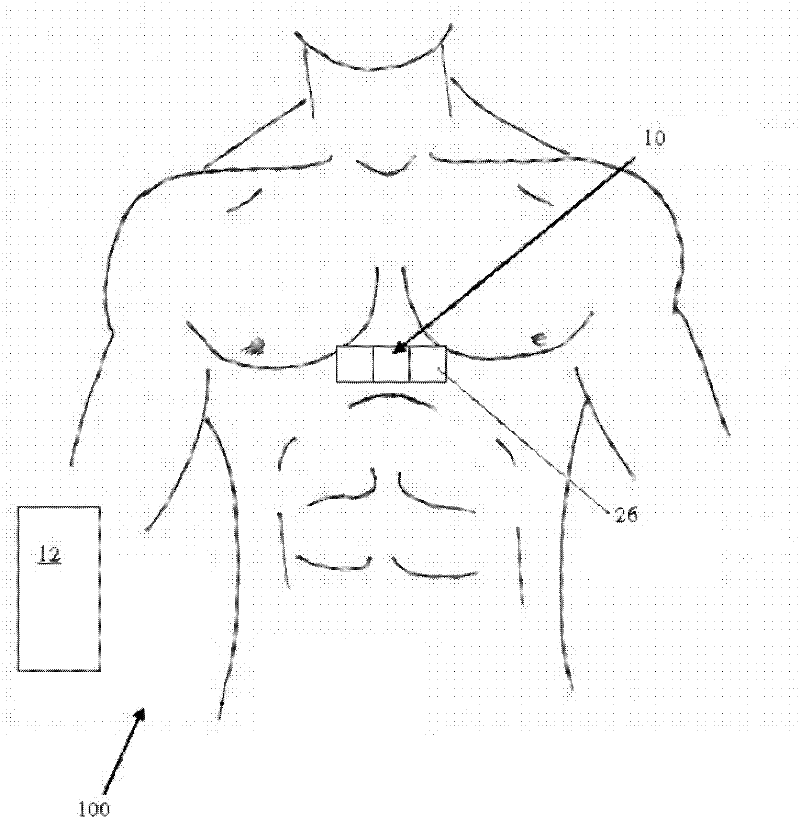 Method and apparatus for obtaining and processing ballistocardiograph data