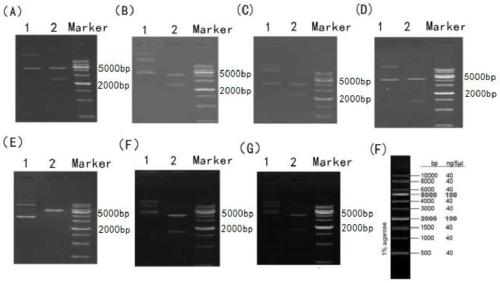 Human Agrin antigen and human Agrin antibody detecting kits and preparing method and application thereof