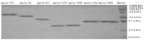 Human Agrin antigen and human Agrin antibody detecting kits and preparing method and application thereof