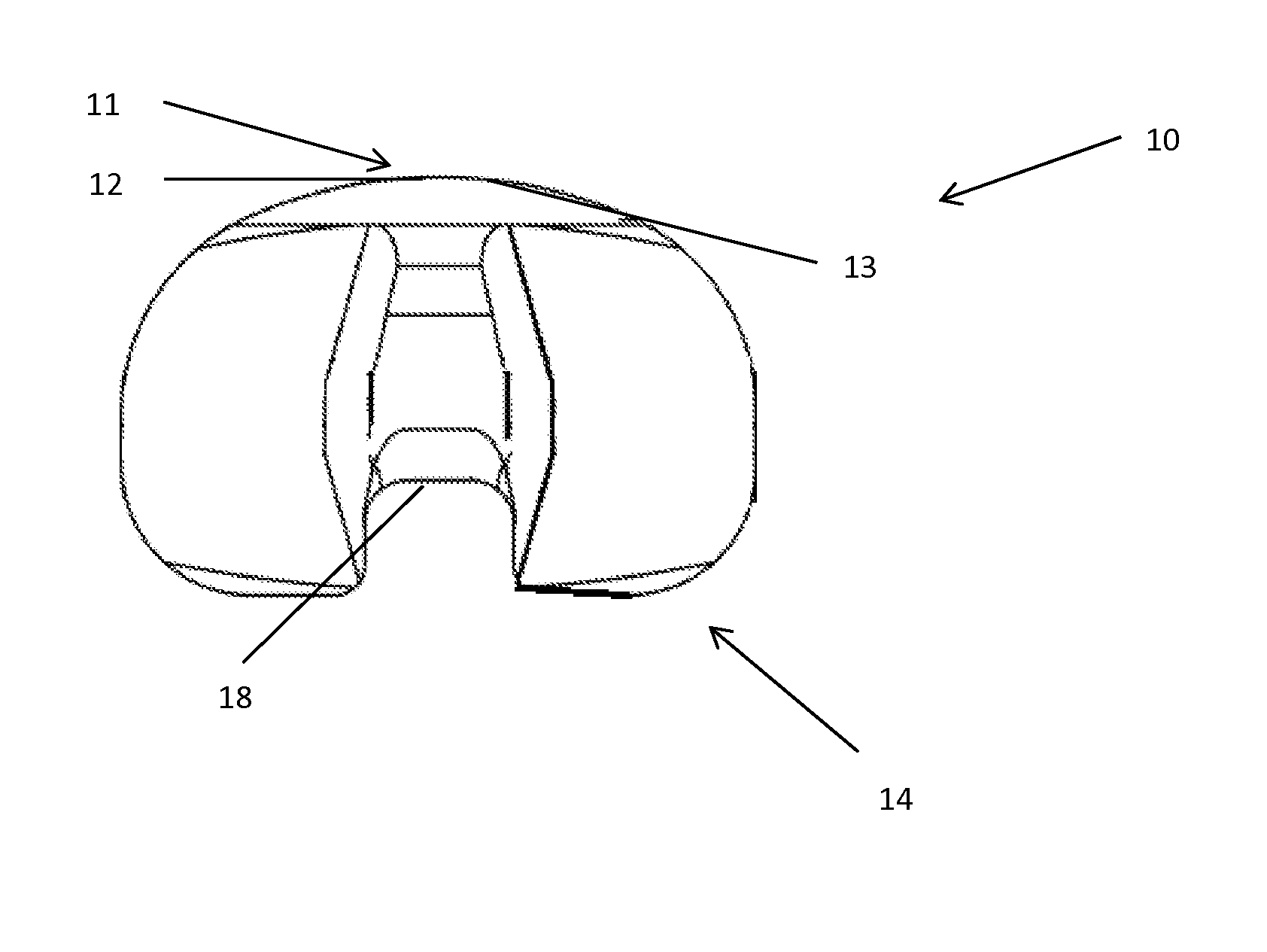 Implant system with pe insert and two tray options