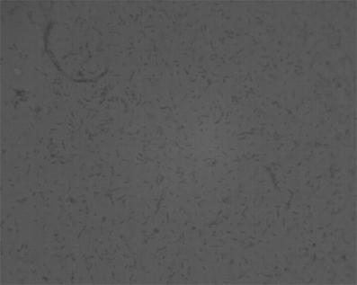 Pseudoalteromonas sp., dextran enzyme-producing method using same and dextran enzyme product