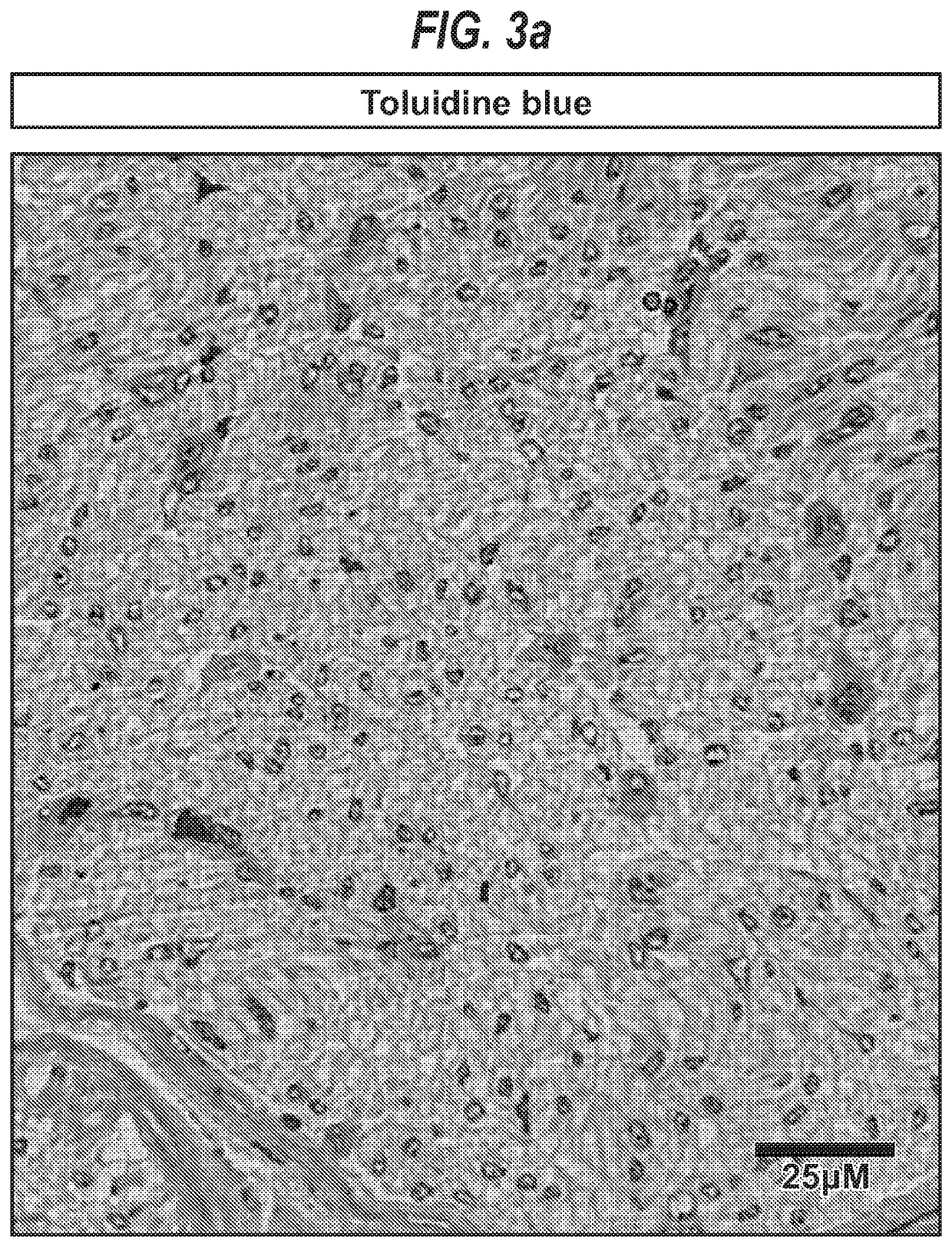 Treatment of disorders associated with inflammation