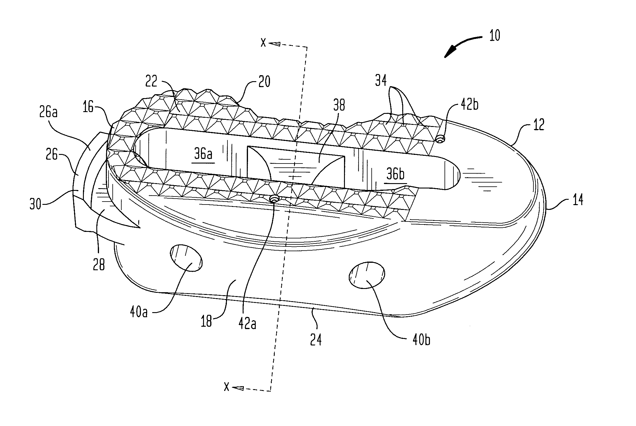 Surgical implant with guiding rail