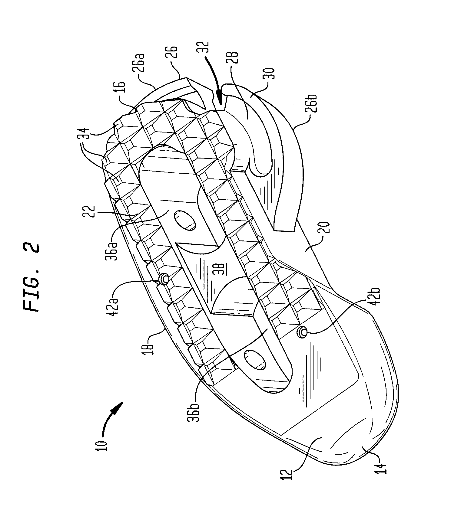 Surgical implant with guiding rail