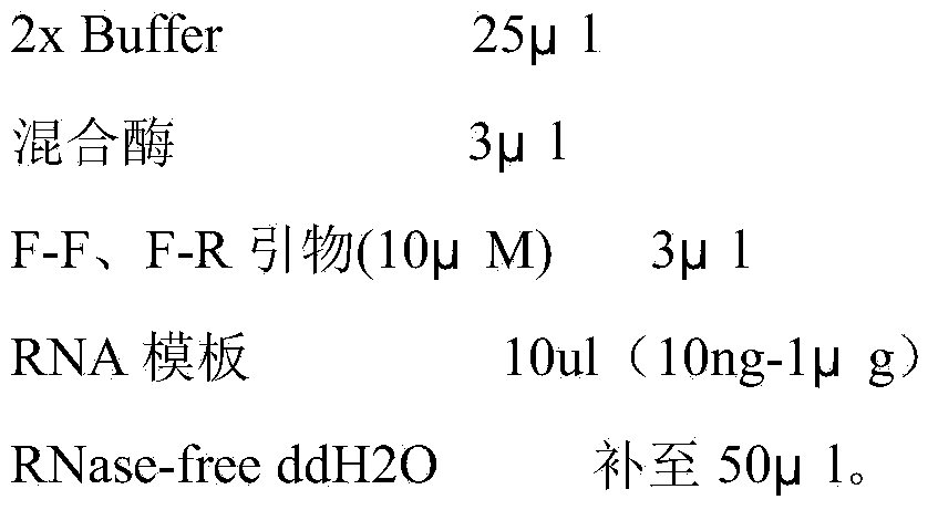 Method for detecting newcastle disease virus nucleic acid by RT-PCR