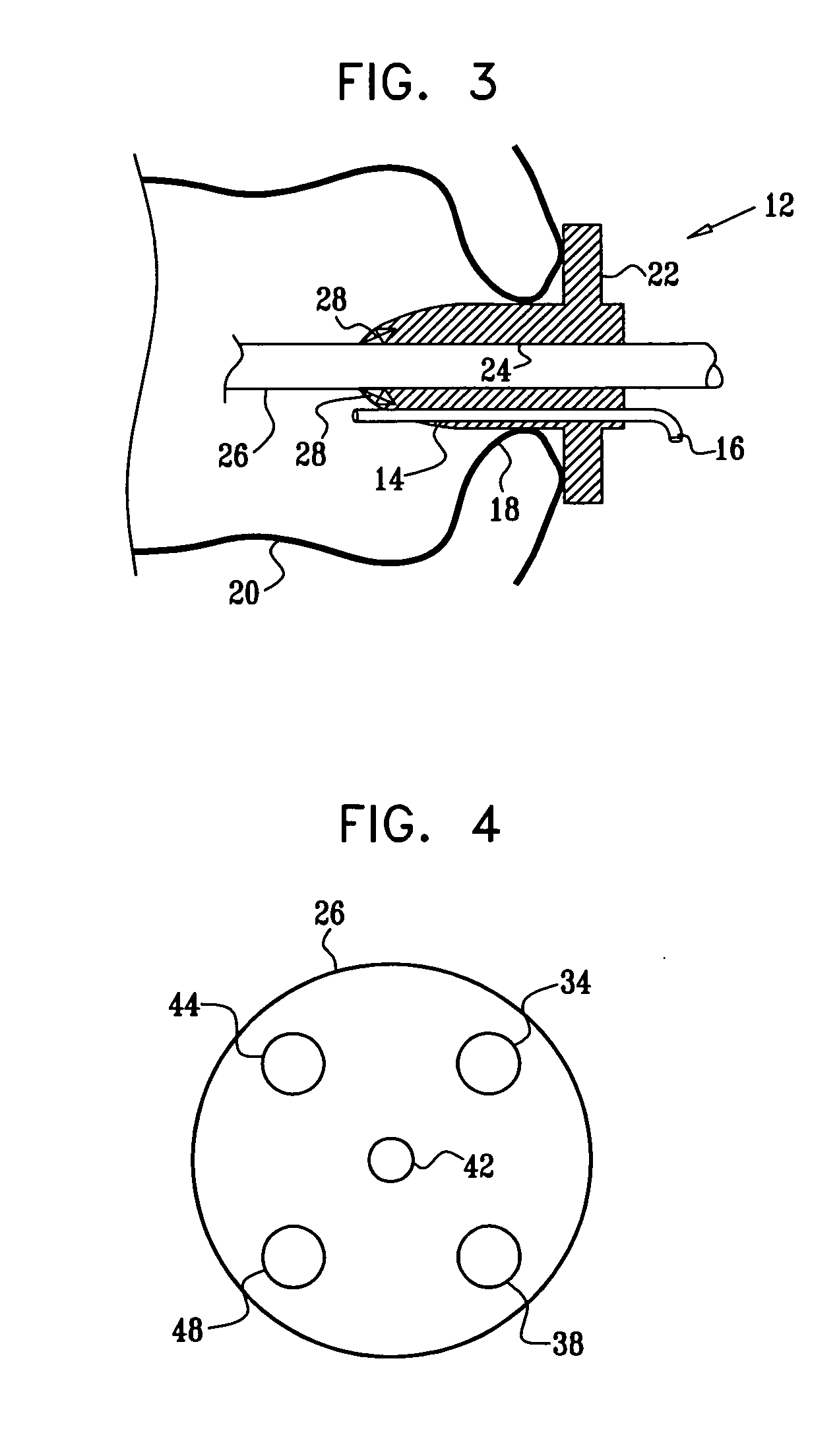 Pressure-propelled system for body lumen