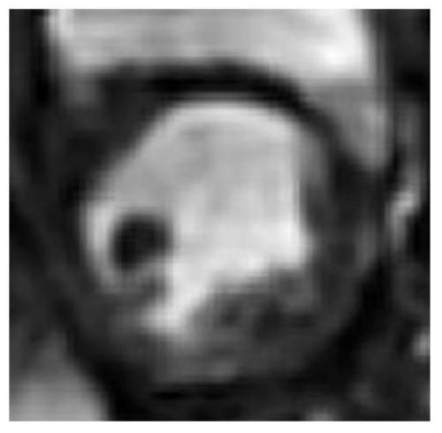 A method for processing cardiac perfusion magnetic resonance images