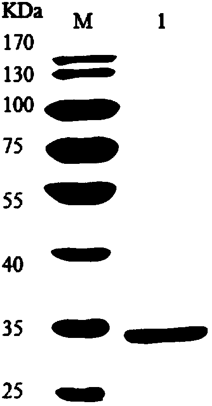 Engineered yeast strain for expressing pseudomonas putida creatininase and application thereof