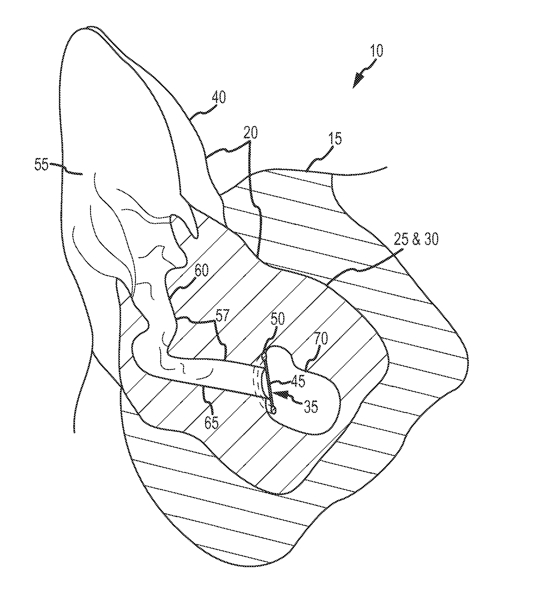 Integrated model for otoscopic procedures