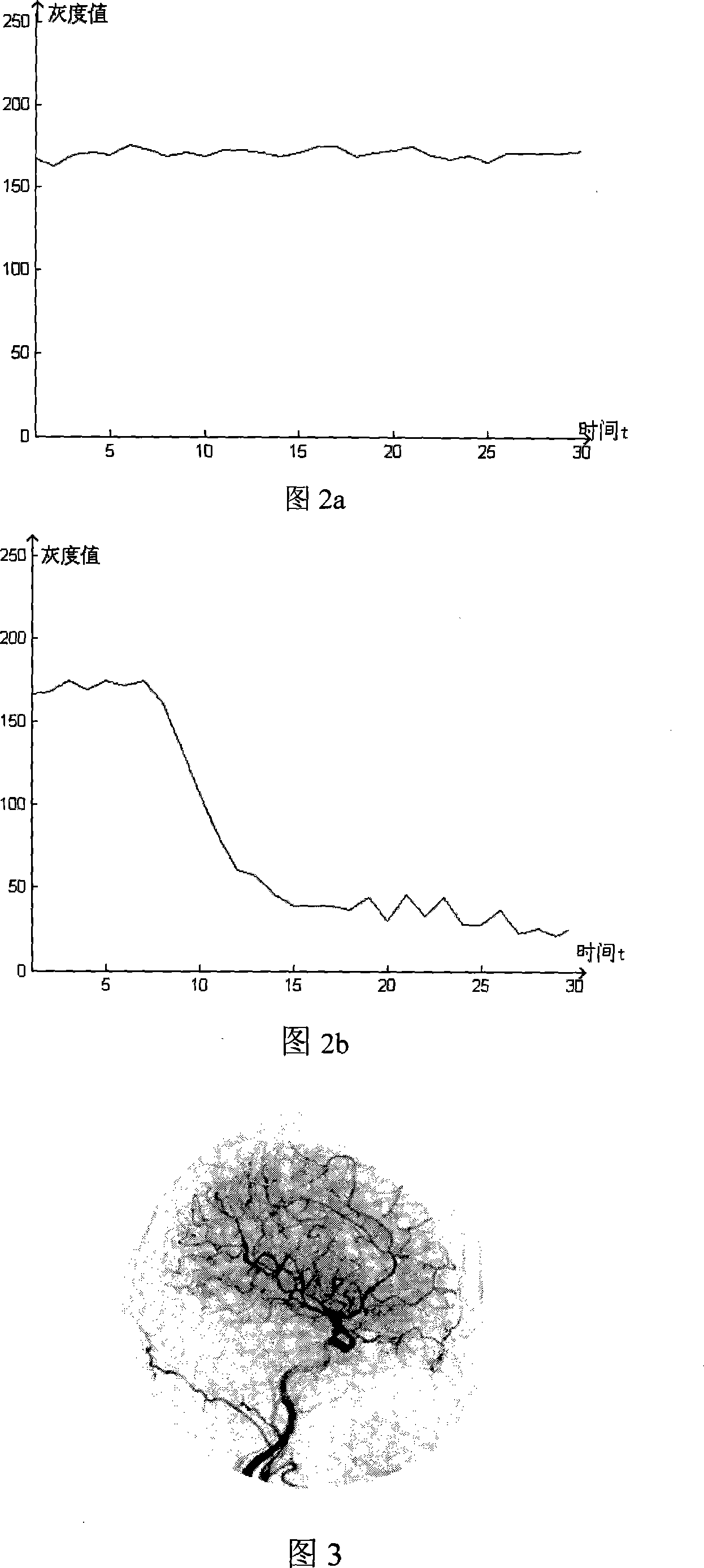 Method for segmenting blood vessel data using serial DSA image