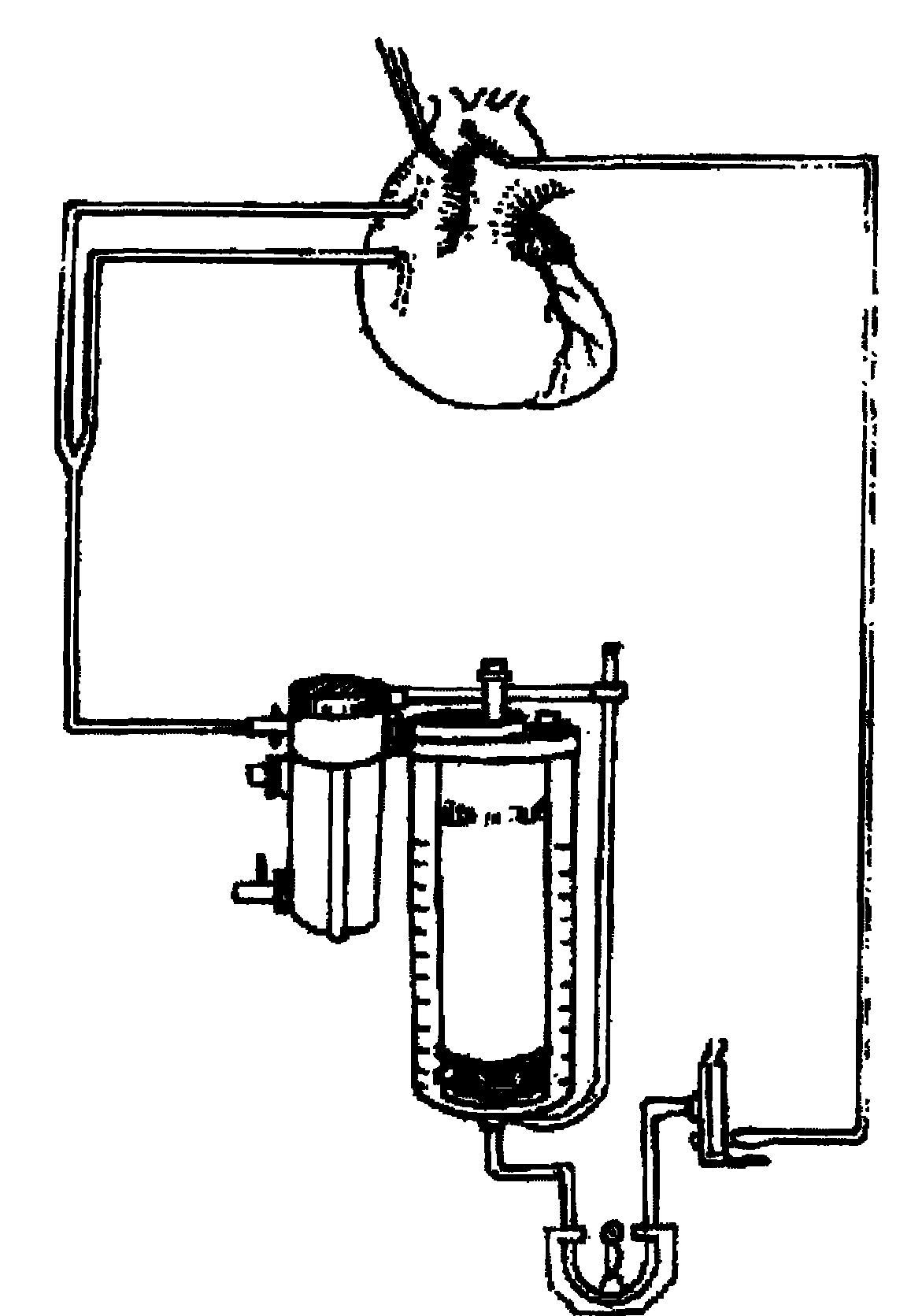 Extracorporeal circulation self oxygen supply system for in-situ curing the pulmonary function injury