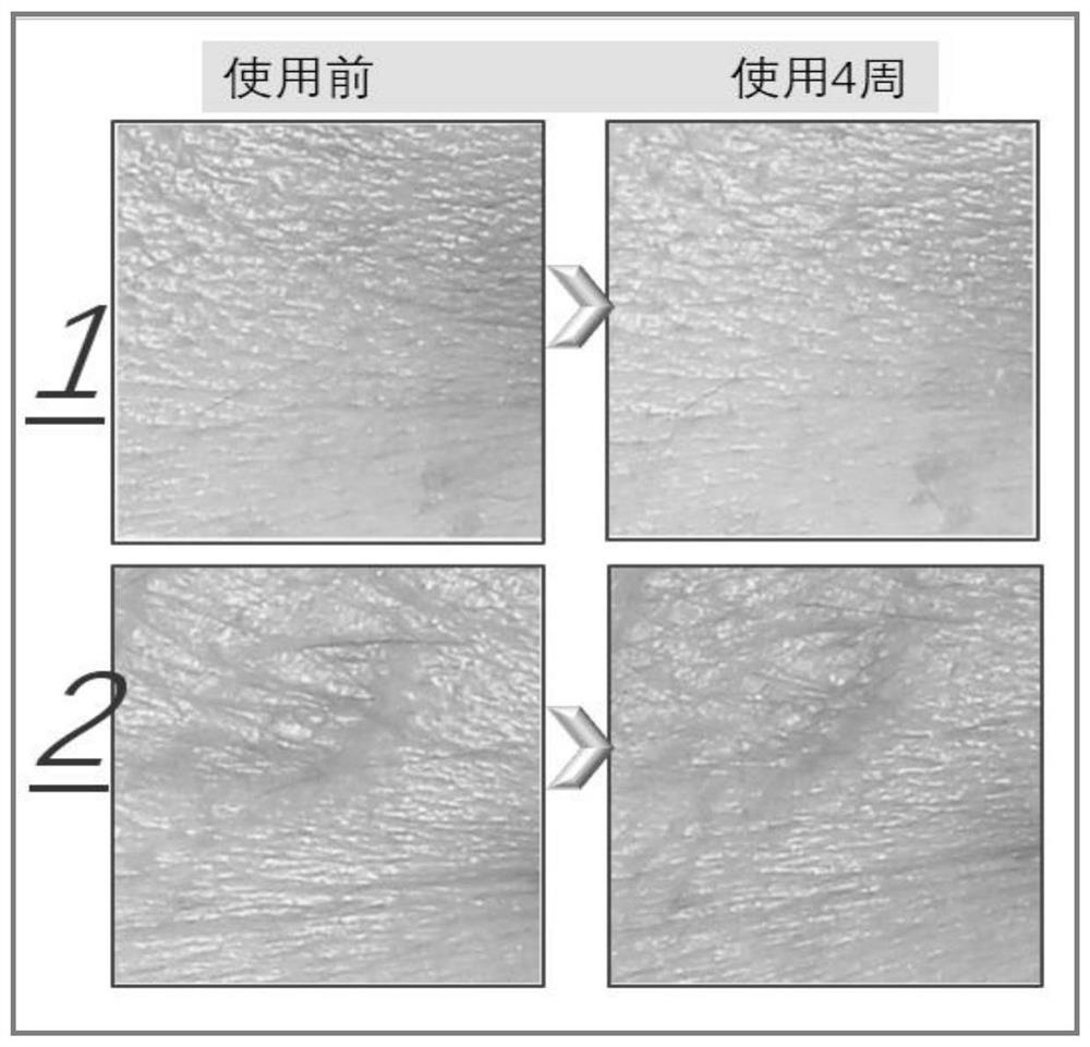 Use method of firming and anti-wrinkle skin care product