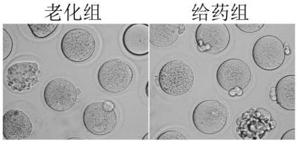 Composition for improving ovarian function and improving ovum and embryo quality and application thereof