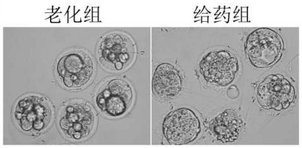 Composition for improving ovarian function and improving ovum and embryo quality and application thereof