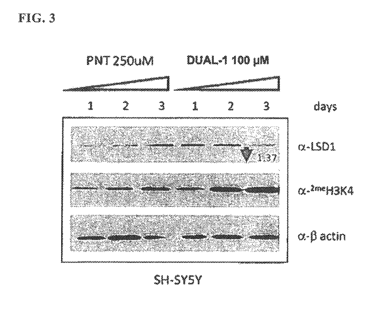 Lysine demethylase inhibitors for myeloproliferative disorders